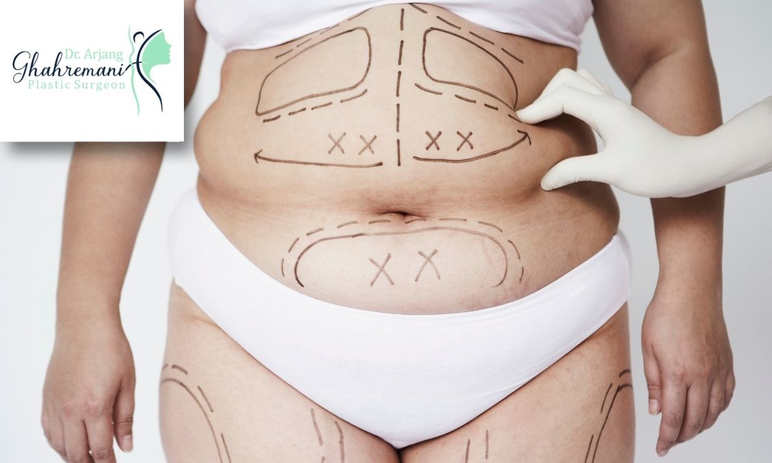 مزایای پیکرتراشی با دستگاه ویزر مزایای پیکرتراشی با دستگاه ویزر
