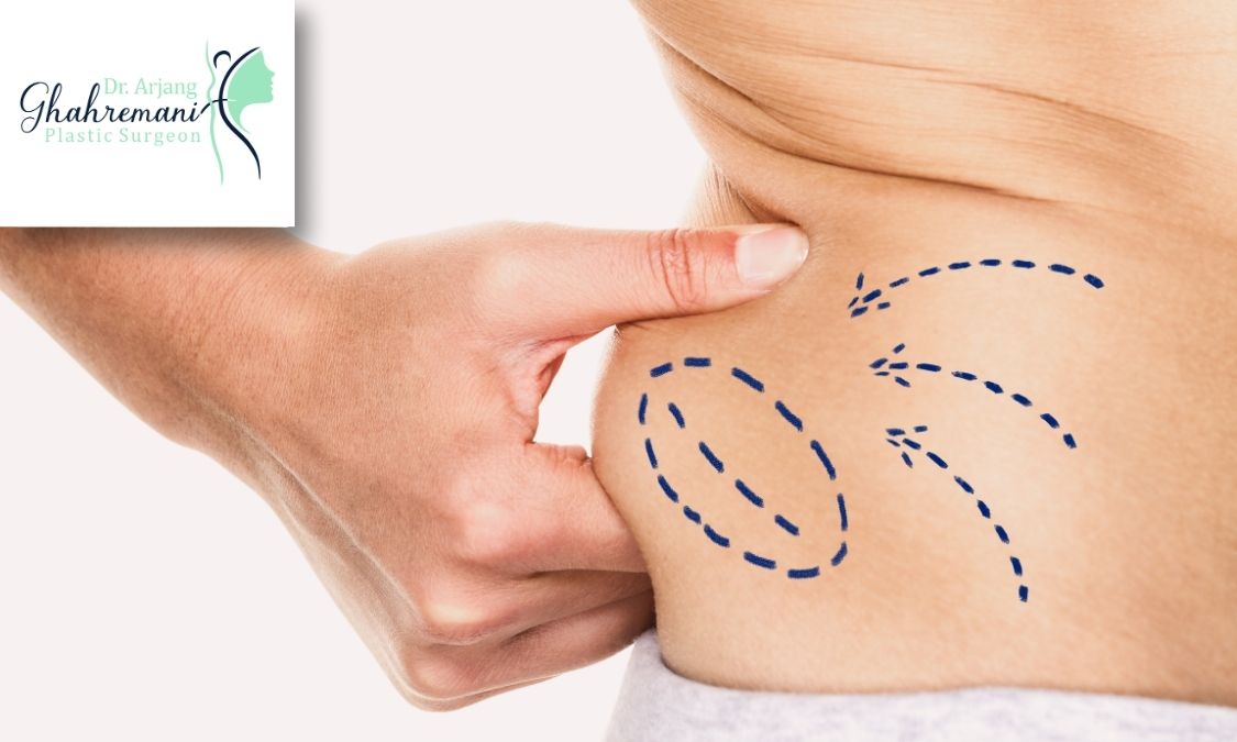 چه کسانی میتوانند این جراحی را انجام دهند؟ چه کسانی میتوانند این جراحی را انجام دهند؟