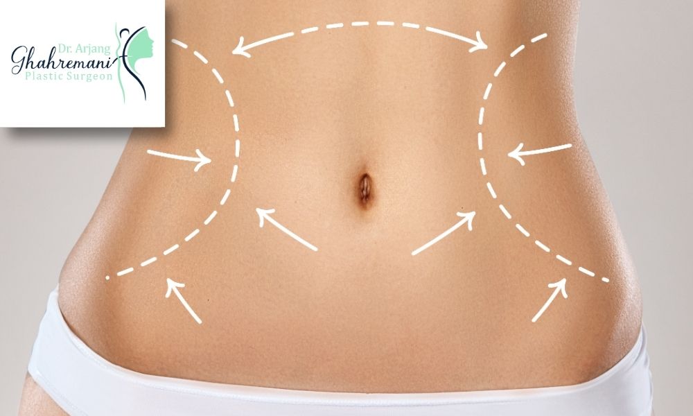 از روش vaserlipo برای کدام ناحیه از بدن استفاده میشود؟ از روش vaserlipo برای کدام ناحیه از بدن استفاده میشود؟