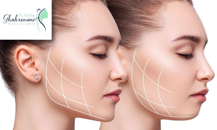 مزایای جراحی بوکال فت
