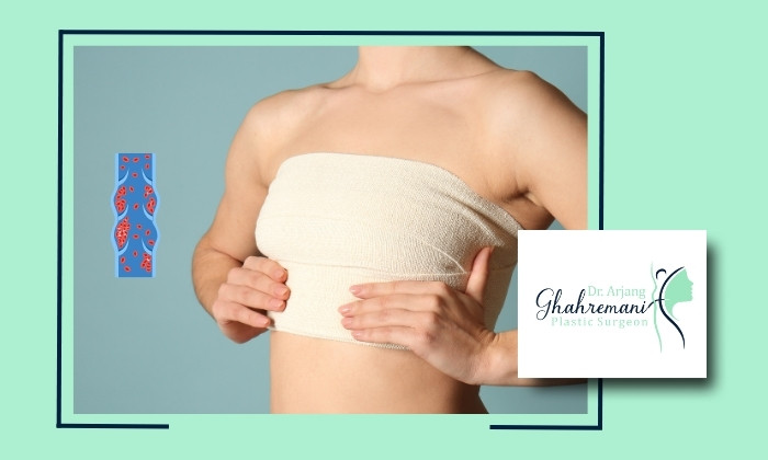 آیا آمبولی بعد از ماموپلاستی شایع است؟ علائم و راههای پیشگیری آیا آمبولی بعد از ماموپلاستی شایع است؟ علائم و راههای پیشگیری