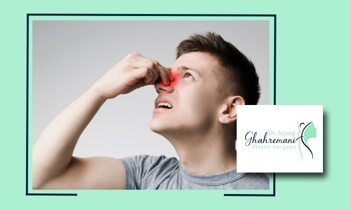 بینی شکسته چه زمانی نیاز به جراحی دارد و مراقبت های بعد از آن چیست؟ بینی شکسته چه زمانی نیاز به جراحی دارد و مراقبت های بعد از آن چیست؟