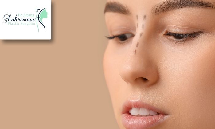 بینی‌های گوشتی و احتمال تغییر شکل