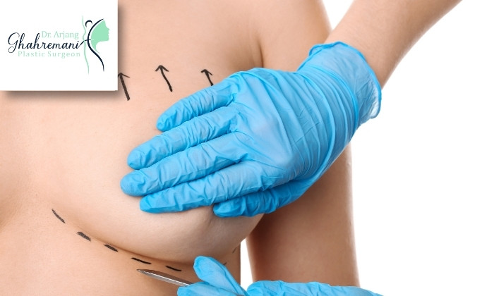 خطر آمبولی بعد از ماموپلاستی خطر آمبولی بعد از ماموپلاستی