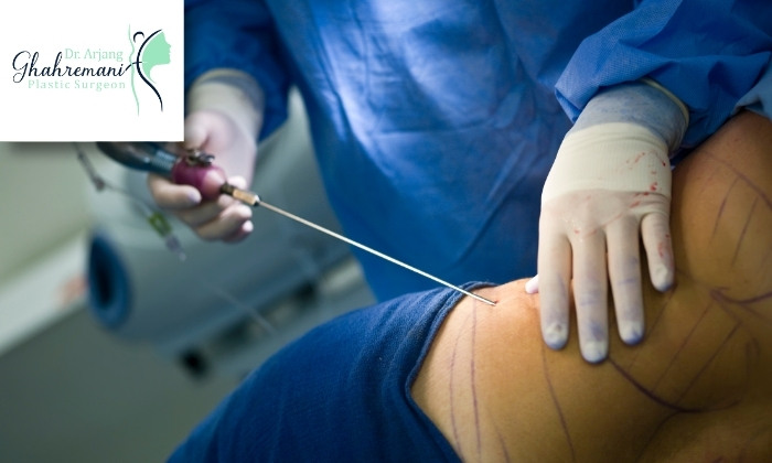 دلایل بروز عفونت