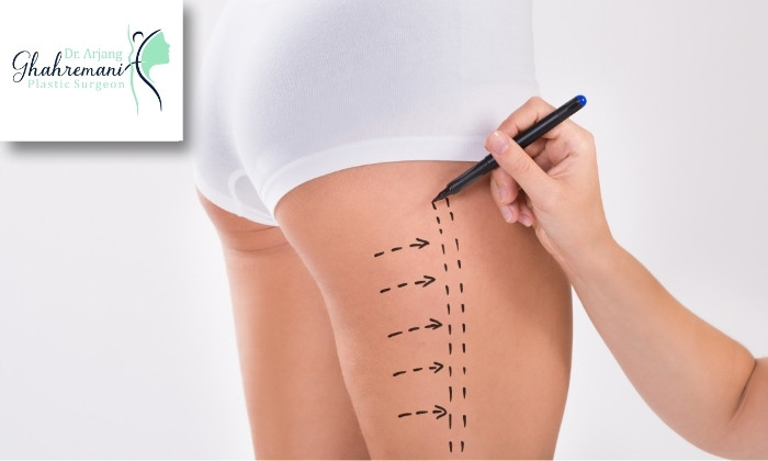 راهکارهای کاهش ورم 