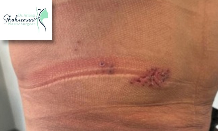 روش‌های درمان عفونت