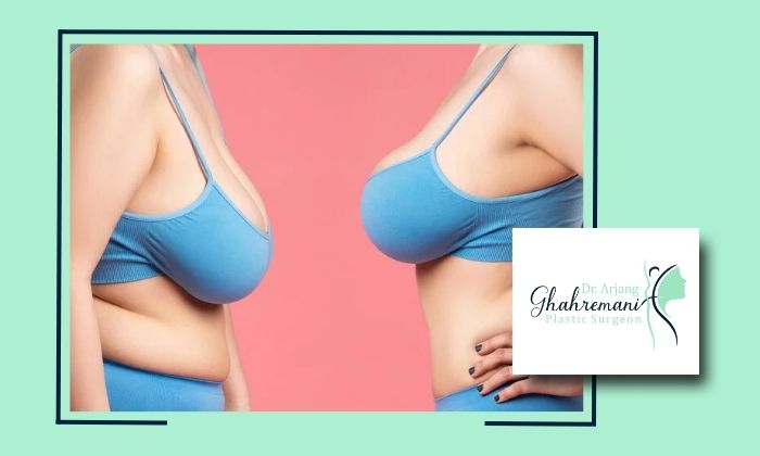 روش‌های مؤثر برای بازسازی فرم سینه‌ها پس از تغییرات وزن یا بارداری
