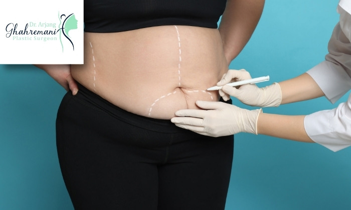 روش‌های پیشگیری