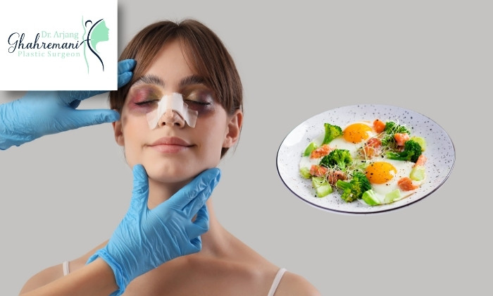 رژیم غذایی بعد از جراحی بینی