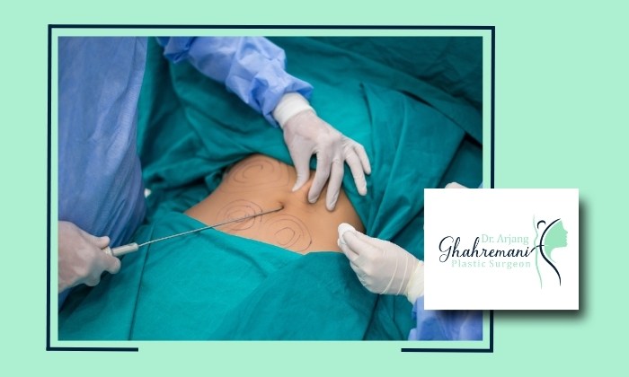 علائم عفونت بعد از لیپوساکشن و راه‌های درمان آن