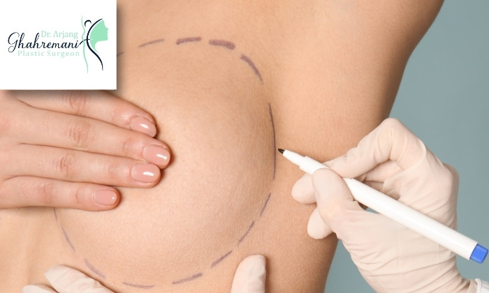 علائم آمبولی بعد از جراحی زیبایی سینه علائم آمبولی بعد از جراحی زیبایی سینه