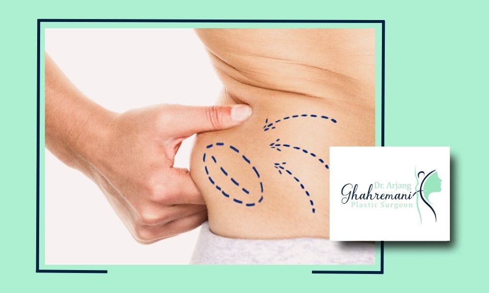 عوارض ویزرلیپو چیست و چگونه از آن پیشگیری کنیم؟