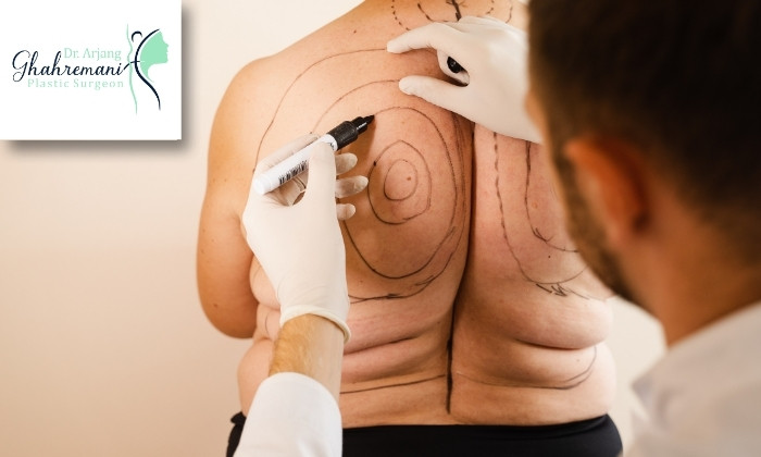 عوامل تاثیرگذار بر شدت التهاب