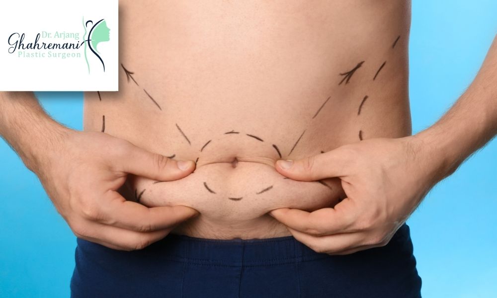 مزایای ابدومینوپلاستی 