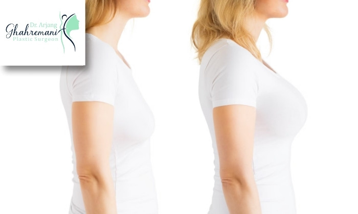 نکات مهم مراقبتی بعد از فرم‌دهی سینه