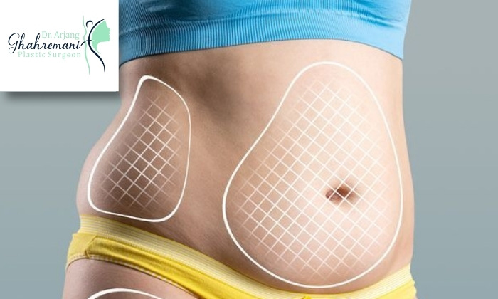 کاندیداهای مناسب پیکرتراشی کاندیداهای مناسب پیکرتراشی